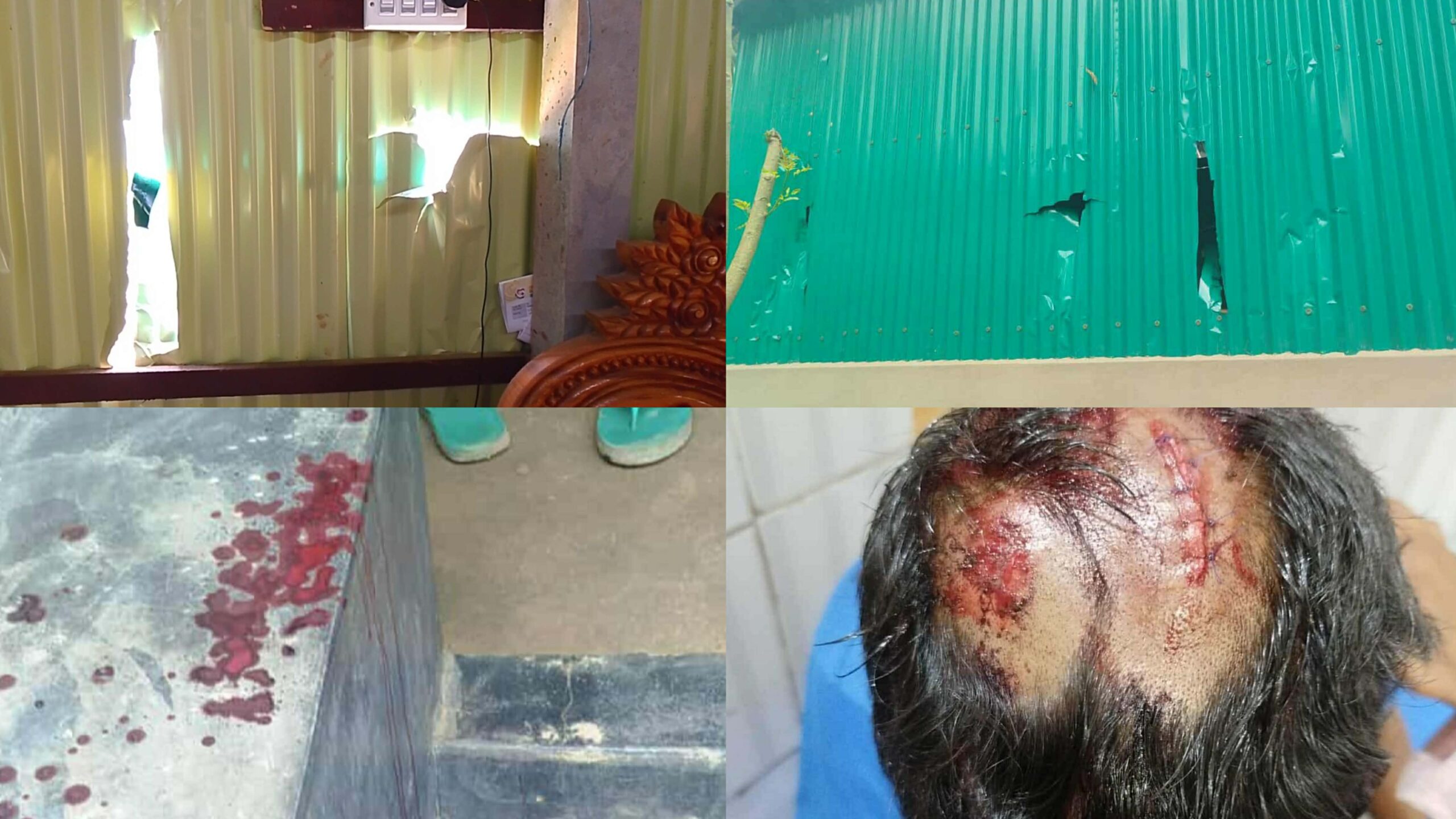 দুর্গাপুরে বাড়িঘরে হামলা ও হত্যাচেষ্টা : ভুক্তভোগী বললেন ‘প্রাণ শঙ্কায় আছি’